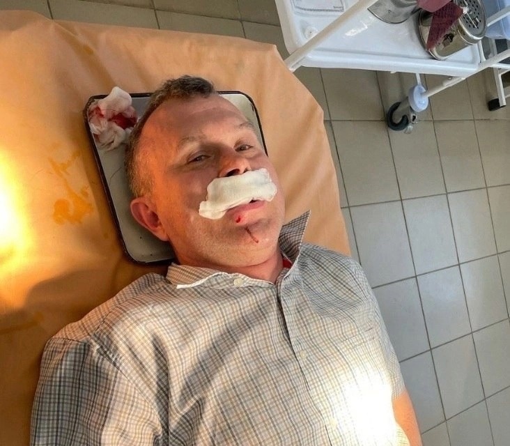 Избили.jpg